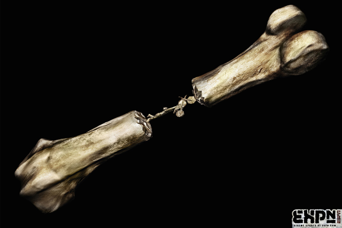 Cet os n'est tenu que par une moto cross : idée originale pour ESPN Extreme Sports