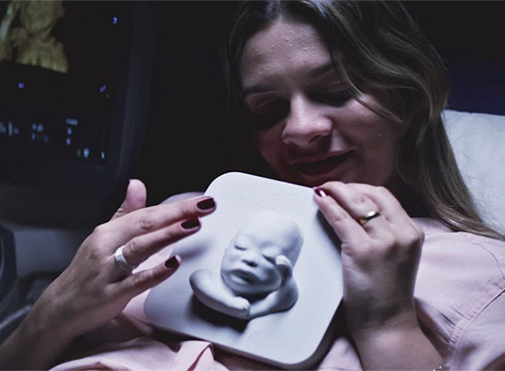 Des échographies imprimées en 3D pour que des femmes aveugles puissent « voir » leur bébé